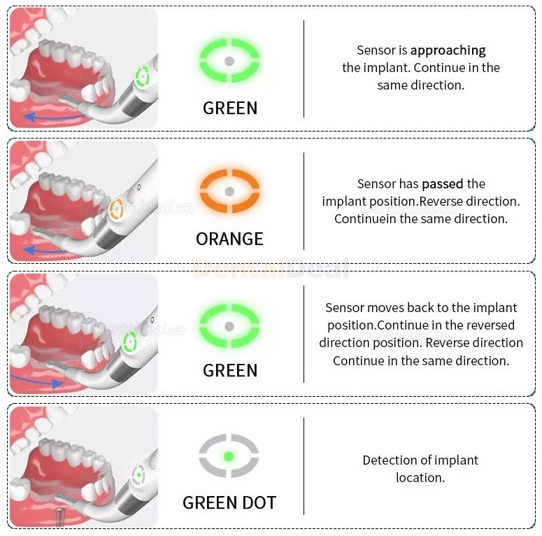 YAHOPE iD1 Dental Implant Locator Smart Implant Finder Detector